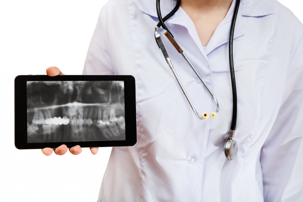 nurse holds tablet pc with X-ray picture of jaws